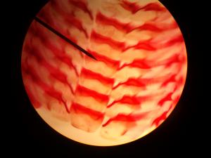 gastropod_radula_(2)1322614038542